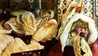 Stanley Spencer - Patient Suffering from Frostbite